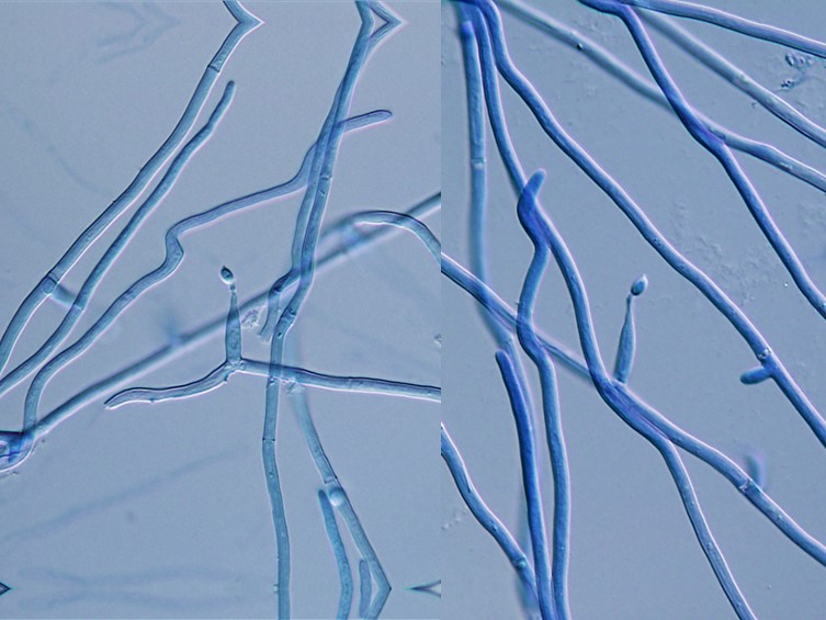 Ophiocordyceps mosingtoensis